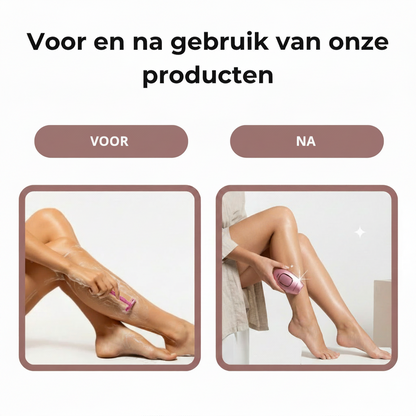 LumiSmooth™ AI IPL Ontharingssysteem